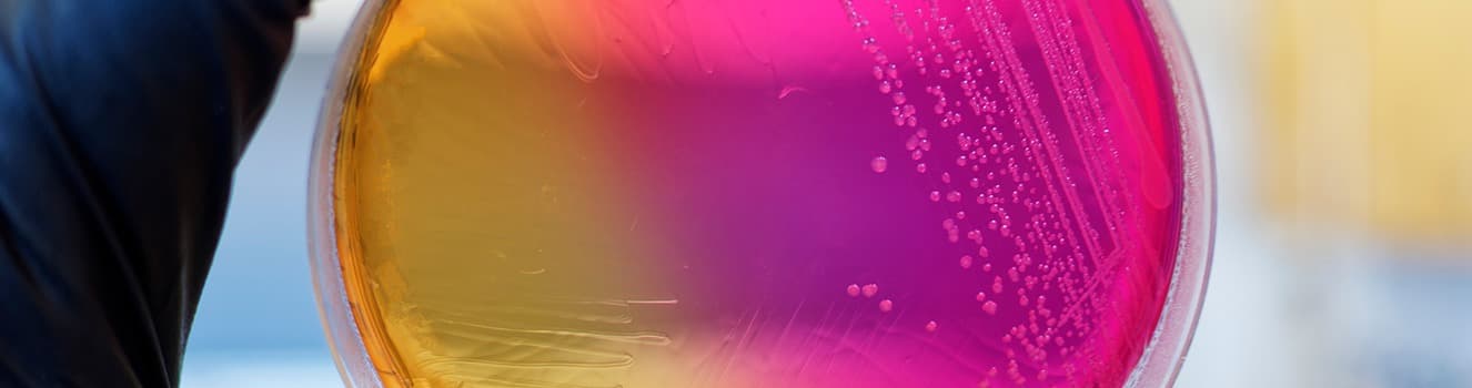 Contamination Control Strategy