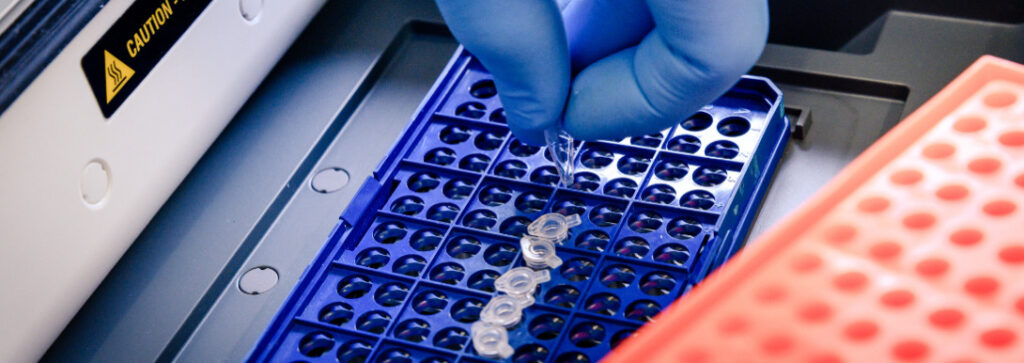 Extractables and Leachables Testing Extractables and Leachables Testing